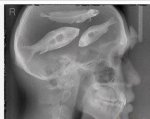Fish brain.jpg