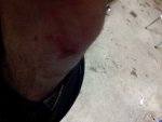 first blood.jpg