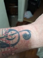Left arm.jpg