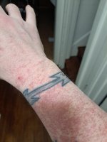 Right arm.jpg