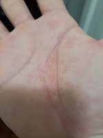 Right hand palm.jpg