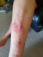 leg.jpg